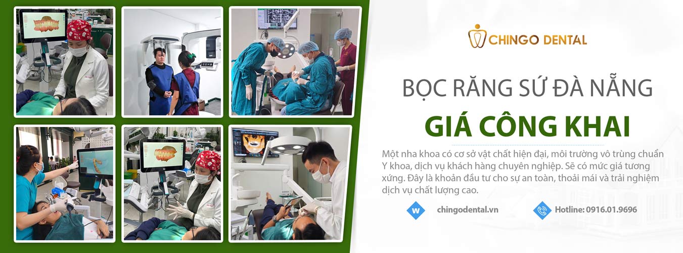 bảng giá bọc răng sứ Đà Nẵng