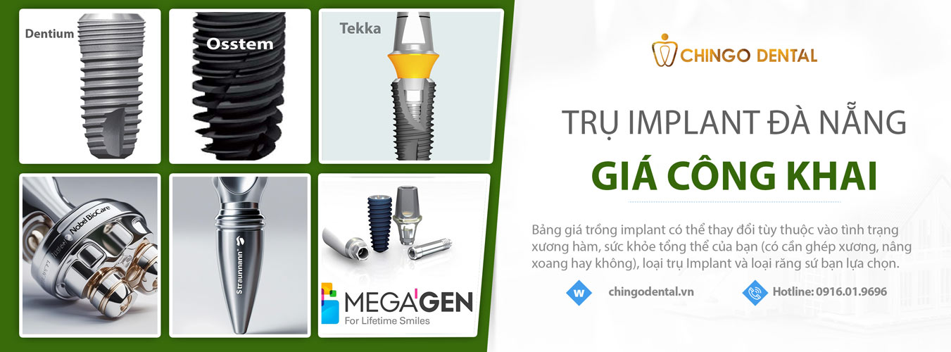 giá làm răng sứ đà nẵng