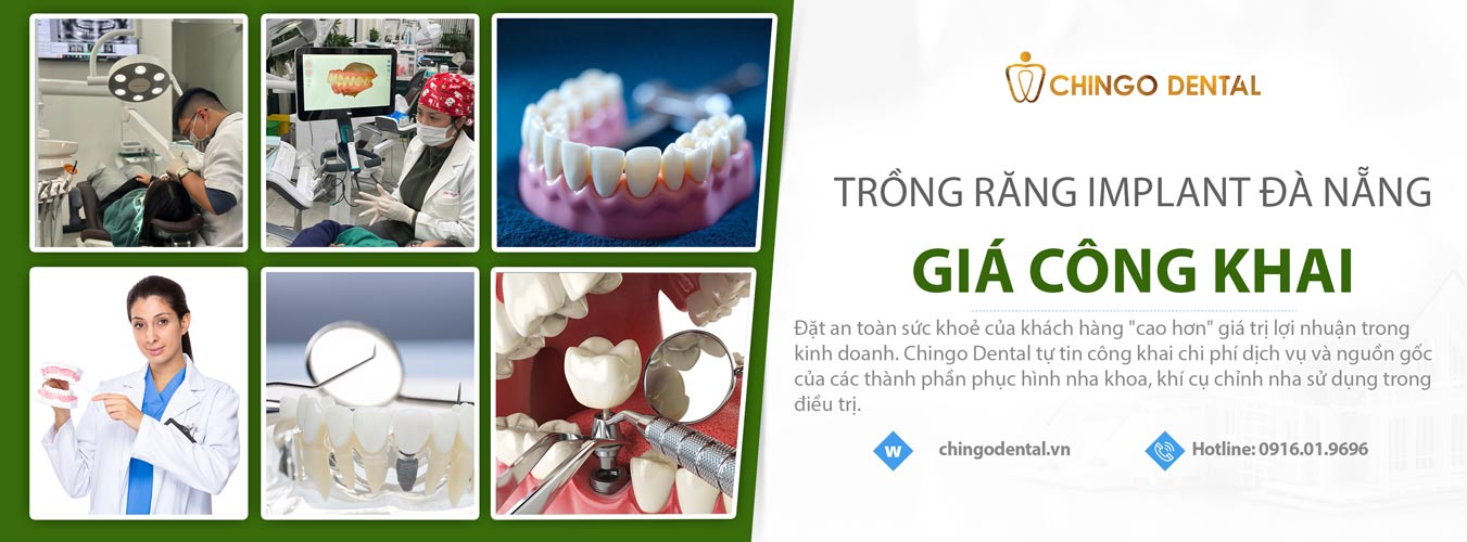 làm răng sứ đà nẵng