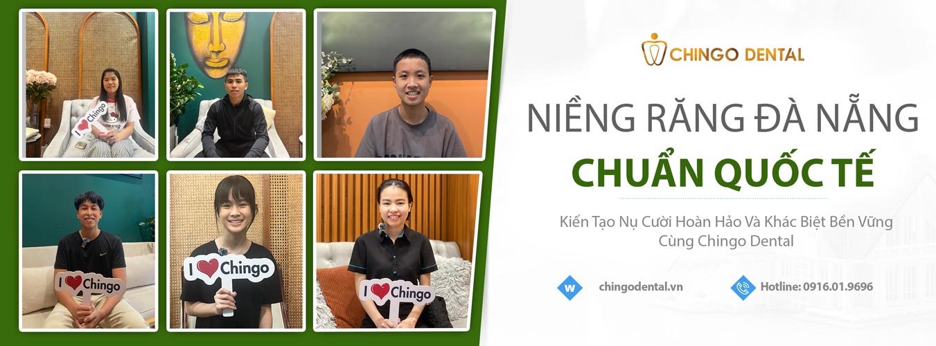 niềng răng đà nẵng