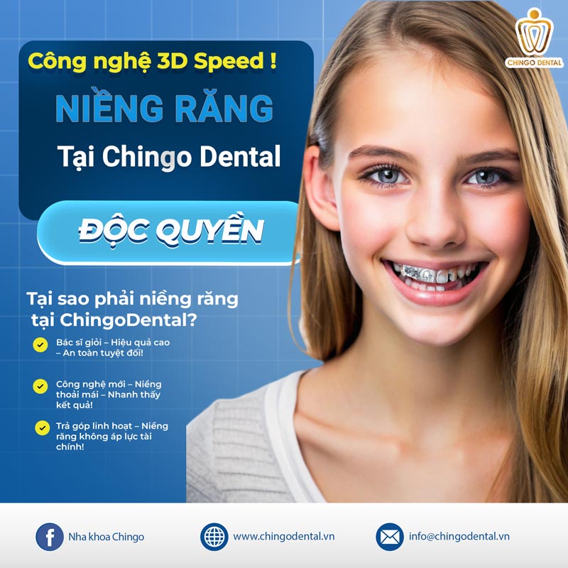 niềng răng ở đà nẵng