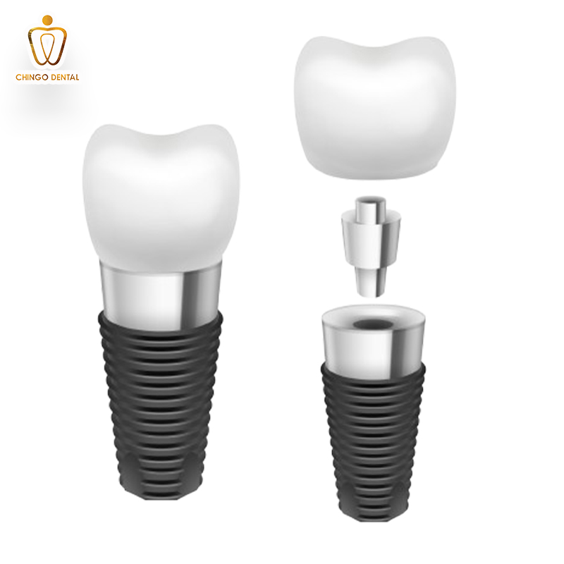 trồng răng implant ở đâu tốt hà nội
