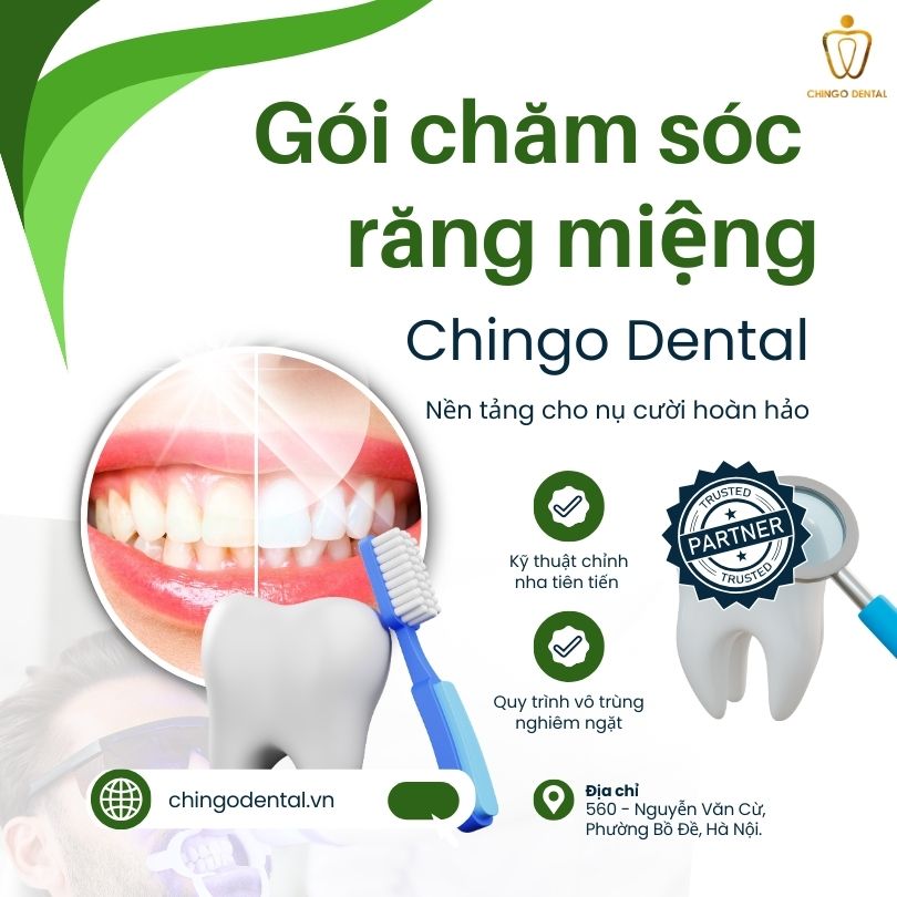 gói chăm sóc răng miệng tại Hà Nội