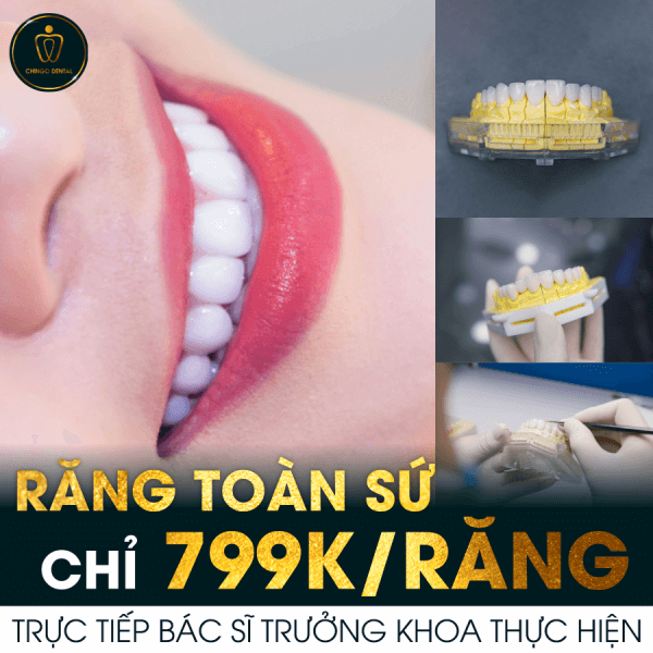 Trang Chủ 22 boc-rang-su-chingo.png