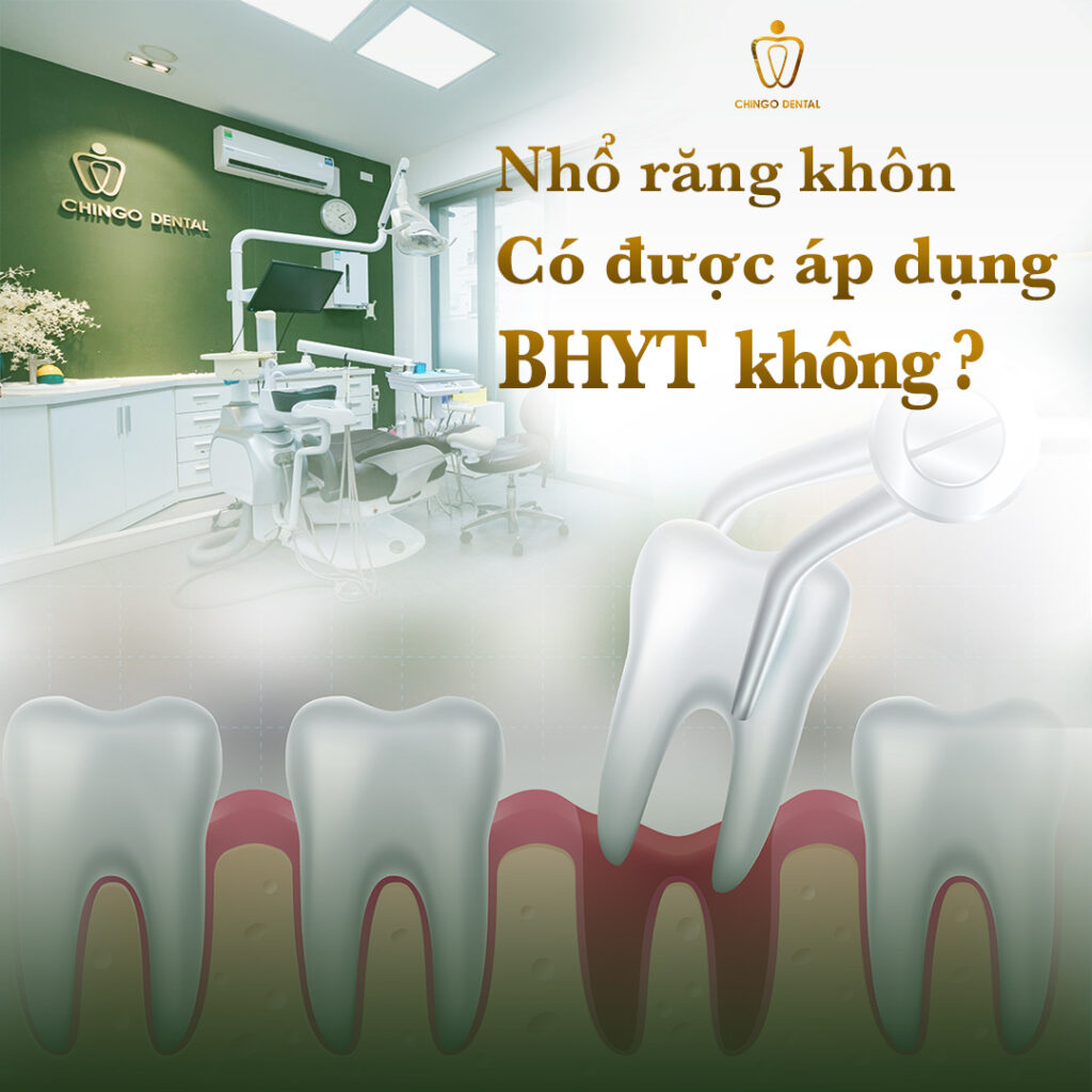 chi phí nhổ răng khôn có bảo hiểm y tế