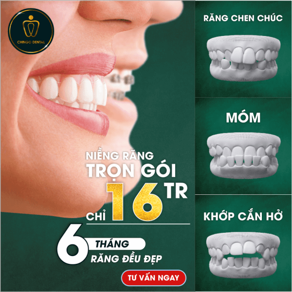 Trang Chủ 23 nieng-rang-chingo.png