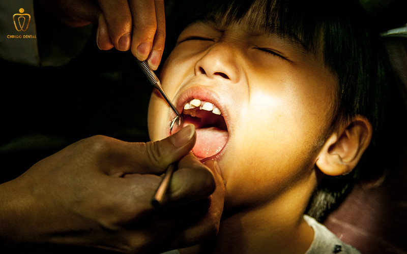 răng mọc lẫy có nhổ được không