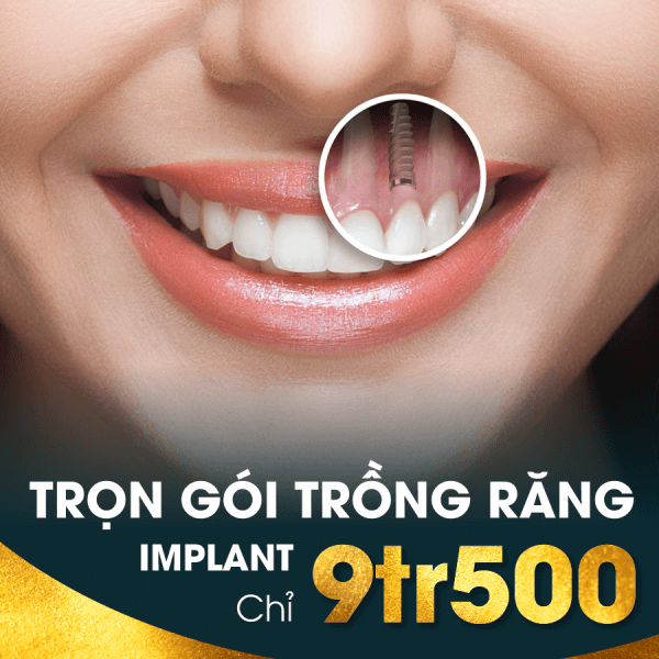 Trang Chủ 24 trong-rang-implant-chingo.png