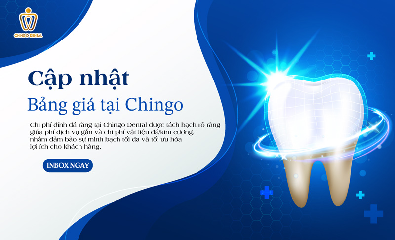 bảng giá gắn đá thẩm mỹ ở Đà Nẵng