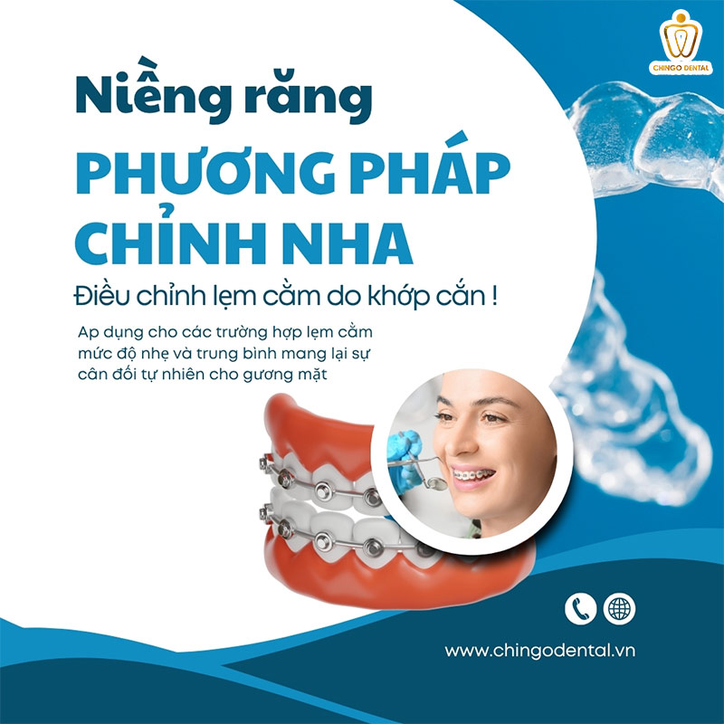 cằm lẹm là gì
