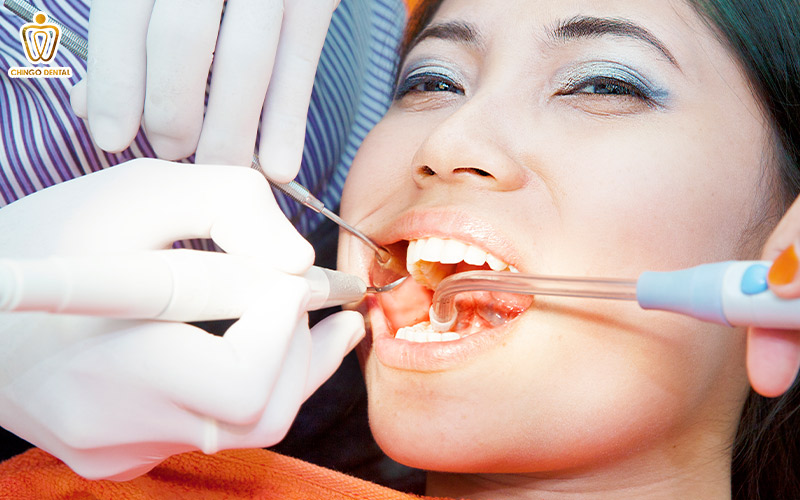 dấu hiệu mọc răng khôn hàm dưới