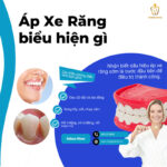 áp xe răng có tự khỏi không