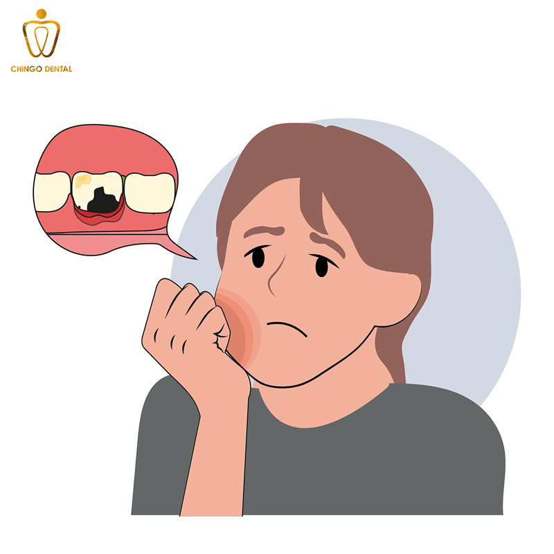 nổi cục cứng ở lợi không đau