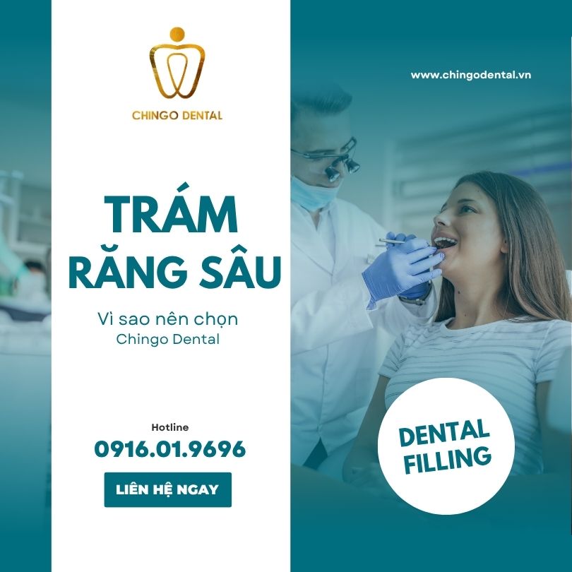 Trám Răng Sâu: Giải Pháp Phục Hồi Răng Thật Toàn Diện 1 trám răng sâu là gì