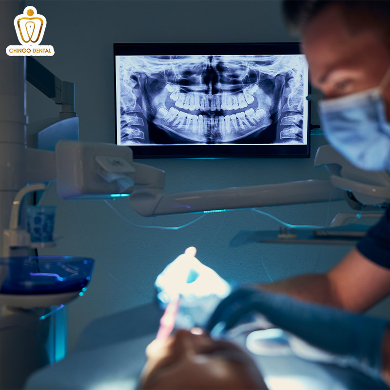 Chụp X-quang Răng: Chìa Khóa Vàng Cho Nụ Cười Khỏe Mạnh Từ Gốc 2 chụp x-quang răng khôn bao nhiêu tiền