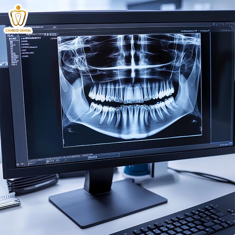 Chụp X-quang Răng: Chìa Khóa Vàng Cho Nụ Cười Khỏe Mạnh Từ Gốc 1 có bầu chụp x-quang răng có sao không