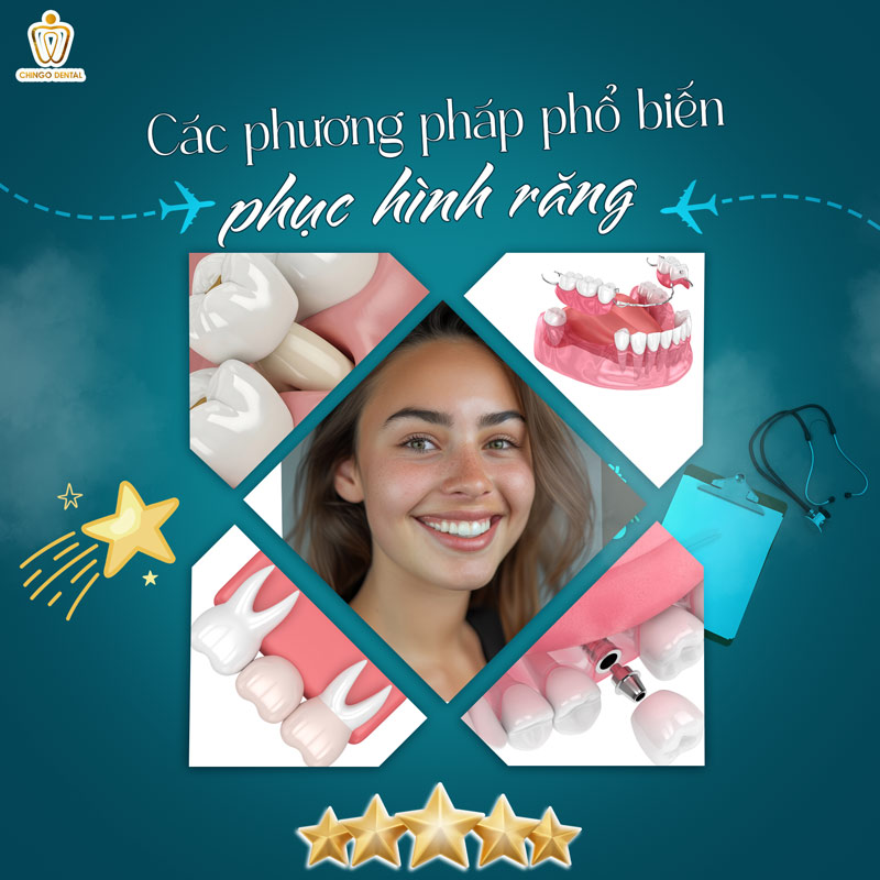 Phục Hình Răng: Giải Pháp Toàn Diện Cho Nụ Cười Và Sức Khỏe Bền Vững 1 kỹ thuật phục hình răng