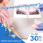 Đau Răng Hàm Đeo Bám? Hiểu Đúng Nguyên Nhân Và Khám Phá Giải Pháp Điều Trị Tận Gốc nhổ răng hàm có đau không