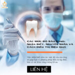 Các Mức Độ Sâu Răng: Nhận Biết, Nguyên Nhân và Cách Điều Trị Hiệu Quả sâu răng mức độ nhẹ