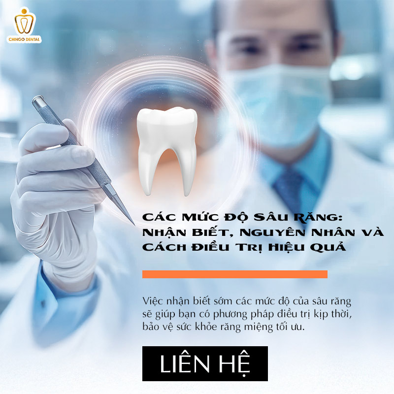 Các Mức Độ Sâu Răng: Nhận Biết, Nguyên Nhân và Cách Điều Trị Hiệu Quả 5 sâu răng mức độ nhẹ