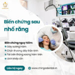 Biến Chứng Sau Nhổ Răng: Cẩm Nang Toàn Diện Để Nhận Biết Và Phòng Ngừa Hiệu Quả biến chứng sau khi nhổ răng khôn hàm dưới
