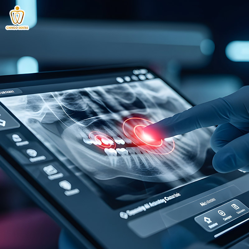 biến chứng sau khi nhổ răng khôn
biến chứng sau nhổ răng
