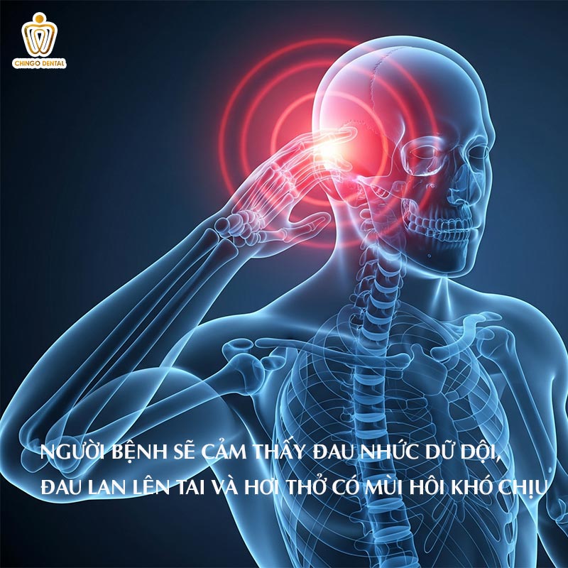 biến chứng sau nhổ răng số 8
