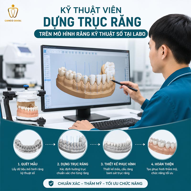 Phục Hình Răng Là Gì: Kỹ Thuật Tái Tạo Nụ Cười Và Chức Năng Ăn Nhai Toàn Diện 3 Kỹ thuật viên dựng trục răng trên mô hình răng kỹ thuật số tại labo