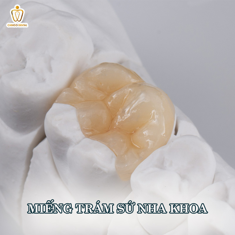 kỹ thuật phục hình răng là gì
