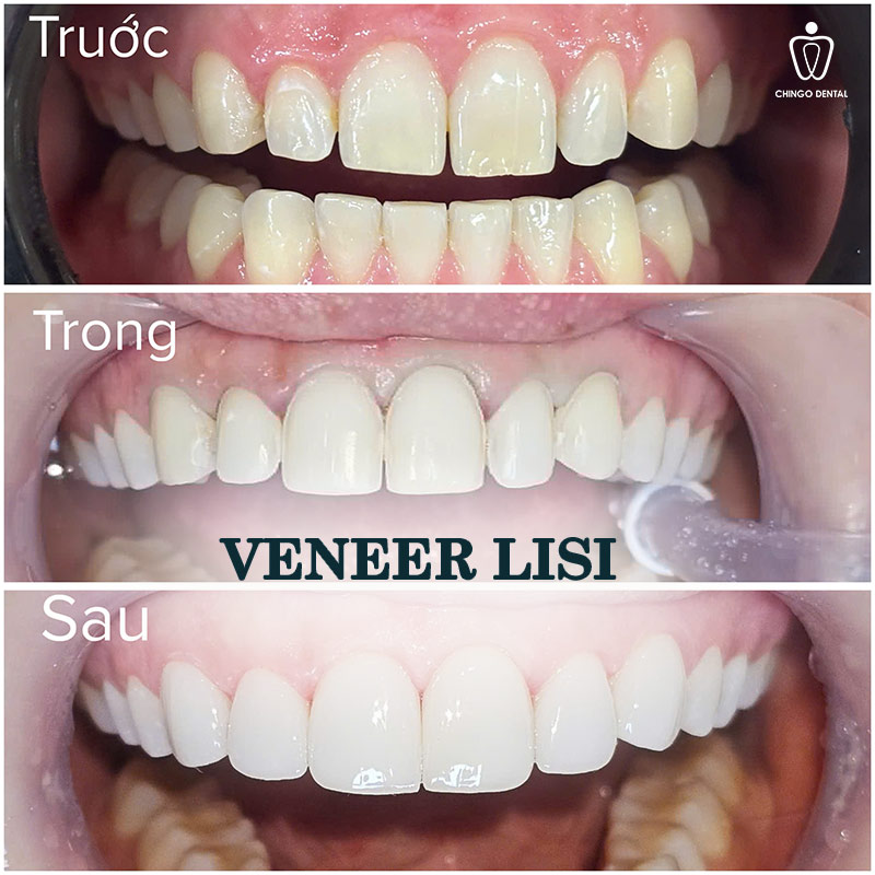 kỹ thuật phục hình răng
