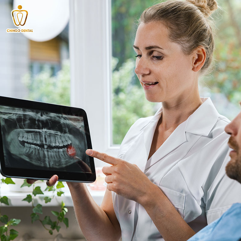 Răng Số 8 Là Răng Gì - Khi Nào Nên Giữ, Khi Nào Cần Nhổ Và Cách Tối Ưu Chi Phí Cho Bạn 5 nhổ răng số 8 có nguy hiểm không