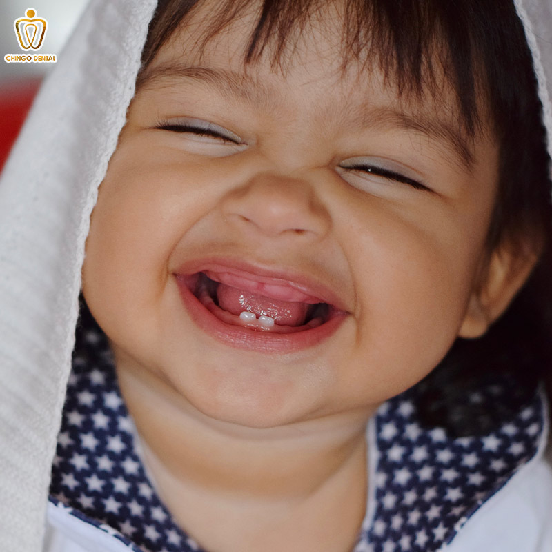 Cẩm Nang Toàn Diện Về Răng Sữa: Những Điều Cha Mẹ Cần Biết Để Bảo Vệ Nụ Cười Đầu Đời Của Bé 1 nho rang sua