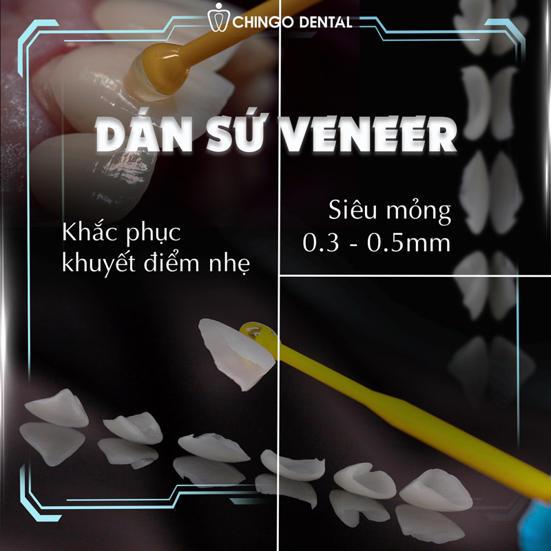 Răng Bị Đen: Cẩm Nang Toàn Diện Về Nguyên Nhân, Điều Trị Và Phòng Ngừa 4 răng bé bị đen