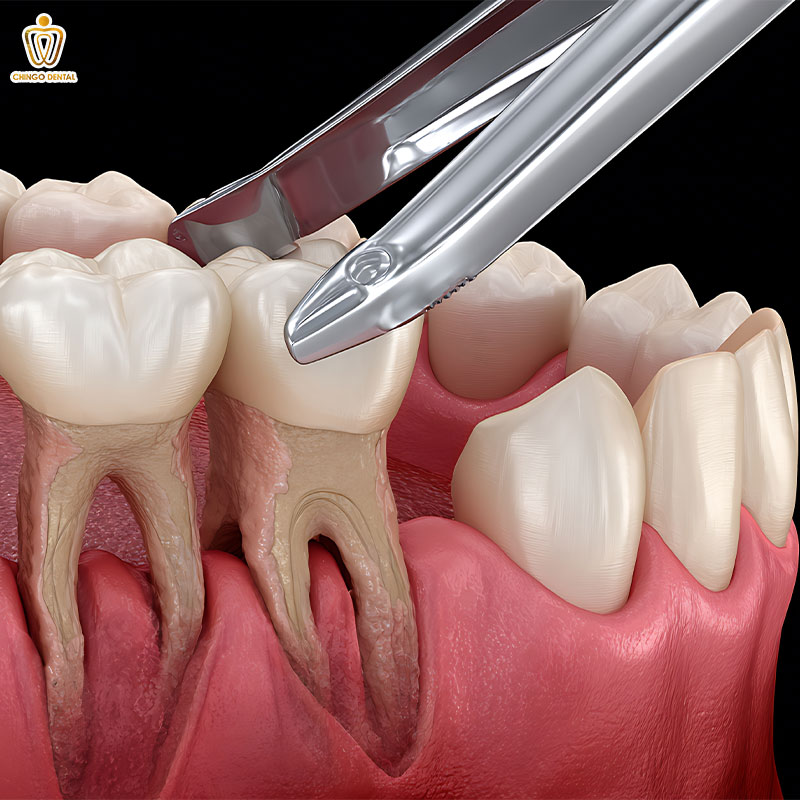 Răng Hàm: Chức Năng, Các Vấn Đề Thường Gặp Và Giải Pháp Điều Trị Tối Ưu 3 răng hàm có thay không
