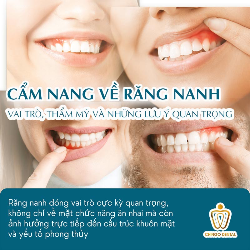 4 Cách Phục Hình Mất Răng Nanh Tốt Nhất Hiện Nay - Giải Pháp Nào Giúp Bạn Có Nụ Cười Chuẩn Tỷ Lệ Vàng? 5 răng nanh có ý nghĩa gì