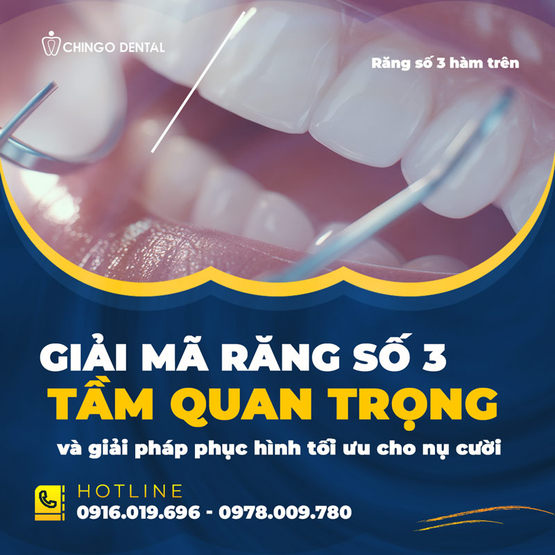 Răng Số 3 Là Răng Nào? Cảnh Báo 6 Hệ Lụy Nguy Hiểm Khi Mất Răng Nanh Mà Bạn Không Nên Xem Thường 3 răng số 3 là răng nào