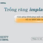 Răng Hàm: Chức Năng, Các Vấn Đề Thường Gặp Và Giải Pháp Điều Trị Tối Ưu trẻ bị sâu răng hàm có mọc lại không