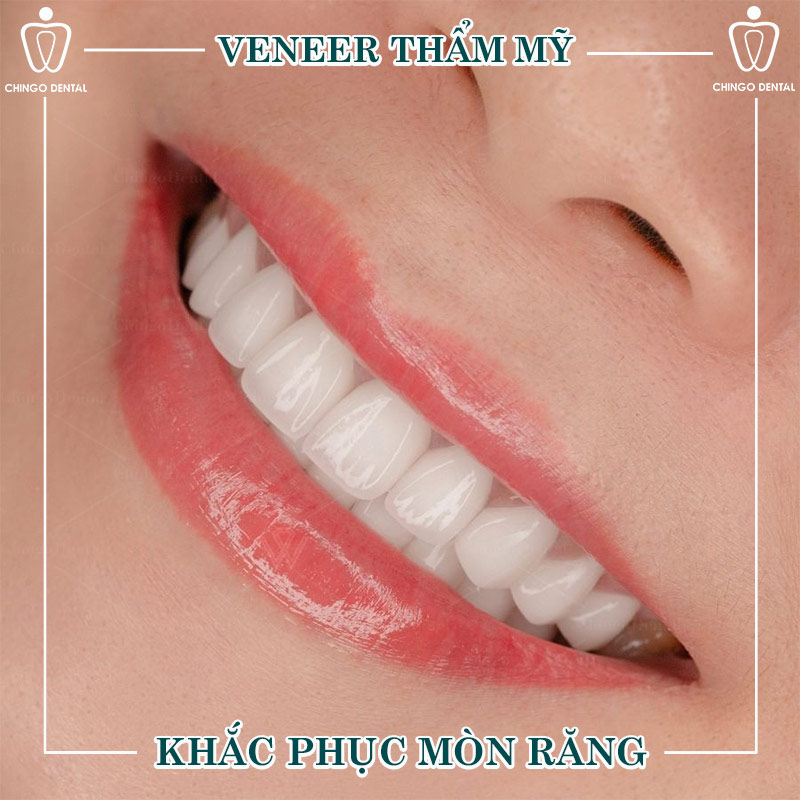 Tổng Quan Bệnh Lý Mòn Răng: Nguyên Nhân, Triệu Chứng Và Cách Điều Trị Hiệu Quả 3 cách xử lý khi răng sữa của trẻ bị mòn