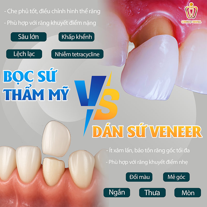 Răng Ố Vàng Xỉn Màu: Nguyên Nhân Và Giải Pháp Lấy Lại Nụ Cười Rạng Rỡ Từ Chuyên Gia 2 răng bị ố vàng phải làm sao