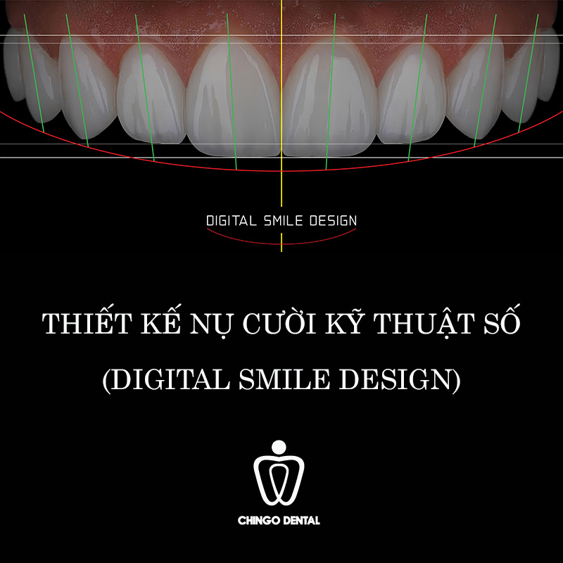 răng có vết ố đen