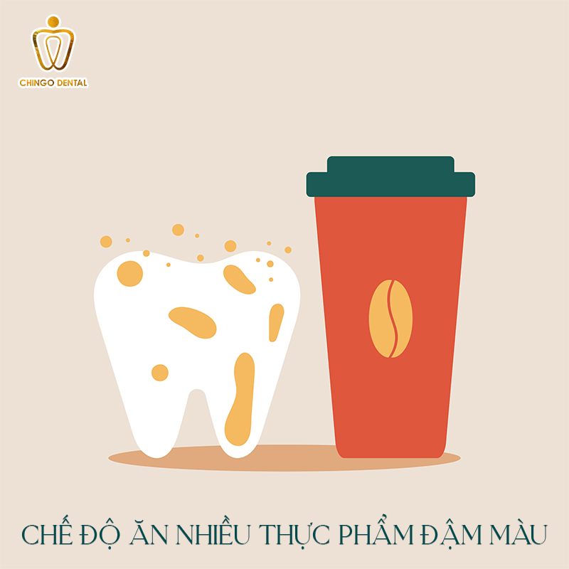 Răng Bị Đổi Màu: Nguyên Nhân Và 3 Giải Pháp Hiệu Quả Khôi Phục Nụ Cười Rạng Rỡ 3 răng sứ có bị đổi màu không