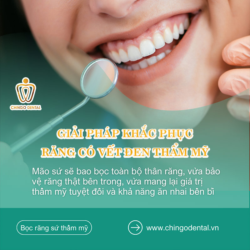 Răng Có Vết Đen Là Gì? Dấu Hiệu Cảnh Báo Bệnh Lý Hay Chỉ Là Mảng Bám? 4 tại sao răng có vết đen