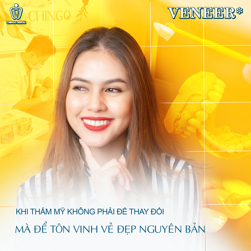 DÁN SỨ VENEER LÀ GÌ? GIÁ THÀNH VÀ NHỮNG ĐIỀU CẦN BIẾT VỀ DÁN RĂNG SỨ 14 dán sứ veneer