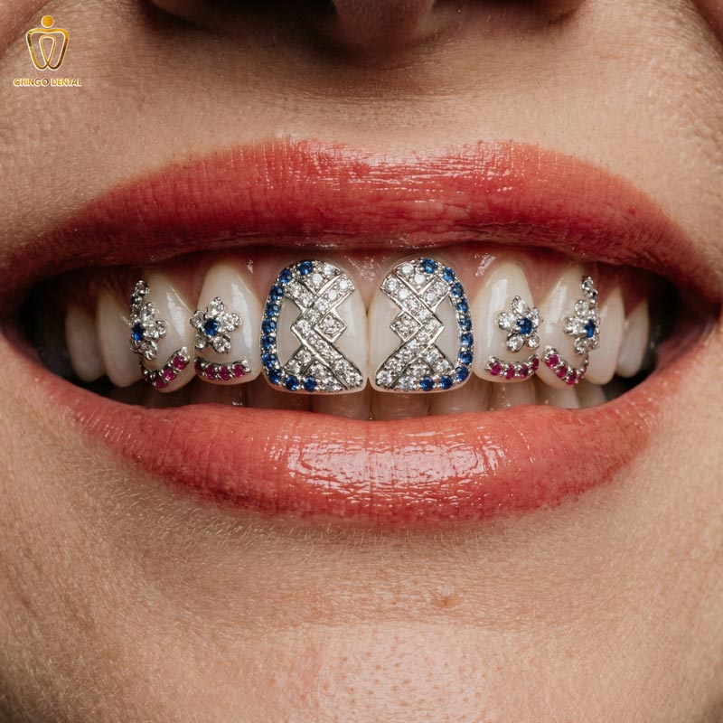 gắn đá răng bao nhiêu tiền