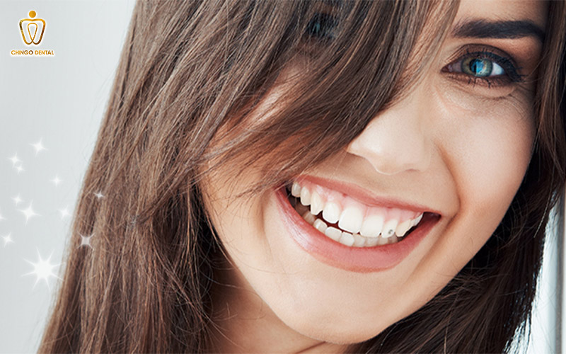 gắn đá răng không khoan lỗ