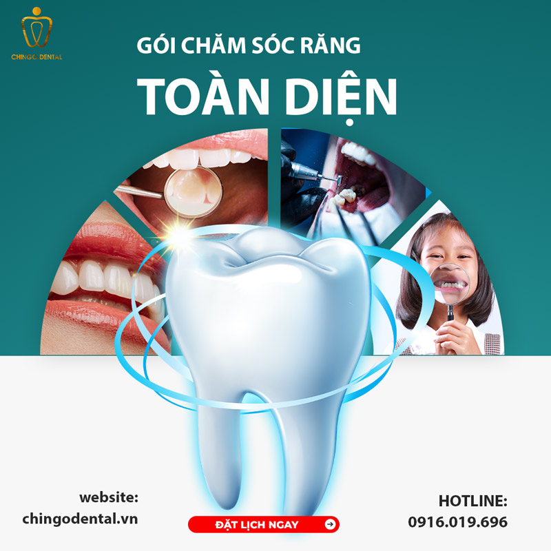 gói chăm sóc răng