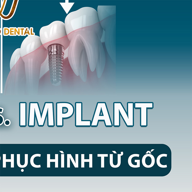 nho nham rang vinh vien