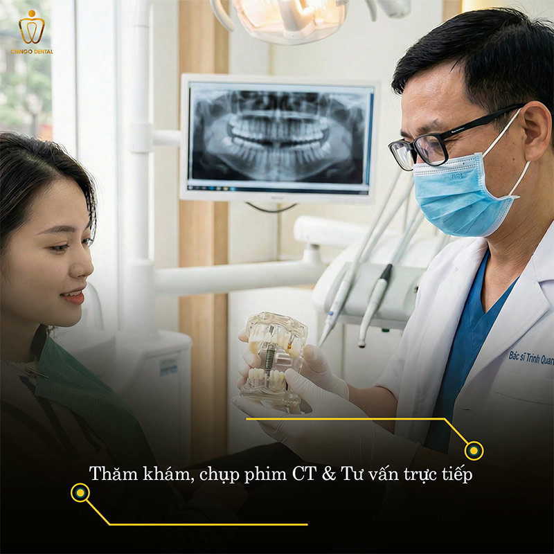 Mất Một Chiếc Răng – Câu Chuyện Không Chỉ Dừng Lại Ở Một Khoảng Trống 1 nhổ răng vĩnh viễn có ảnh hưởng gì không