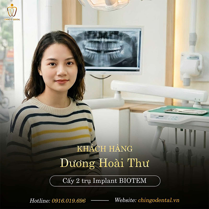 Mất Một Chiếc Răng – Câu Chuyện Không Chỉ Dừng Lại Ở Một Khoảng Trống 2 răng vĩnh viễn bị lung lay có nên nhổ không