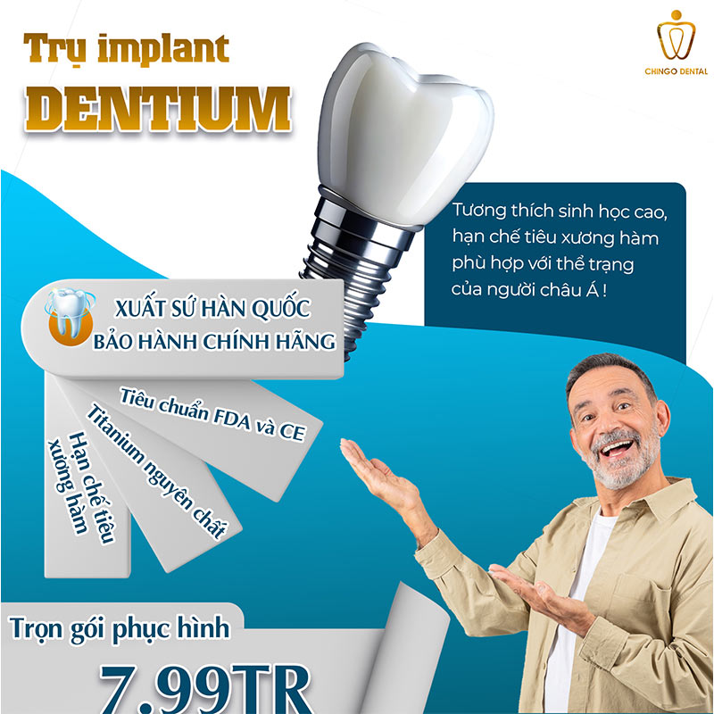Trồng Răng Implant Là Gì? Ưu Nhược Điểm Ra Sao? Quy Trình Và Những Điều Cần Lưu Ý 7 trồng răng implant nha khoa